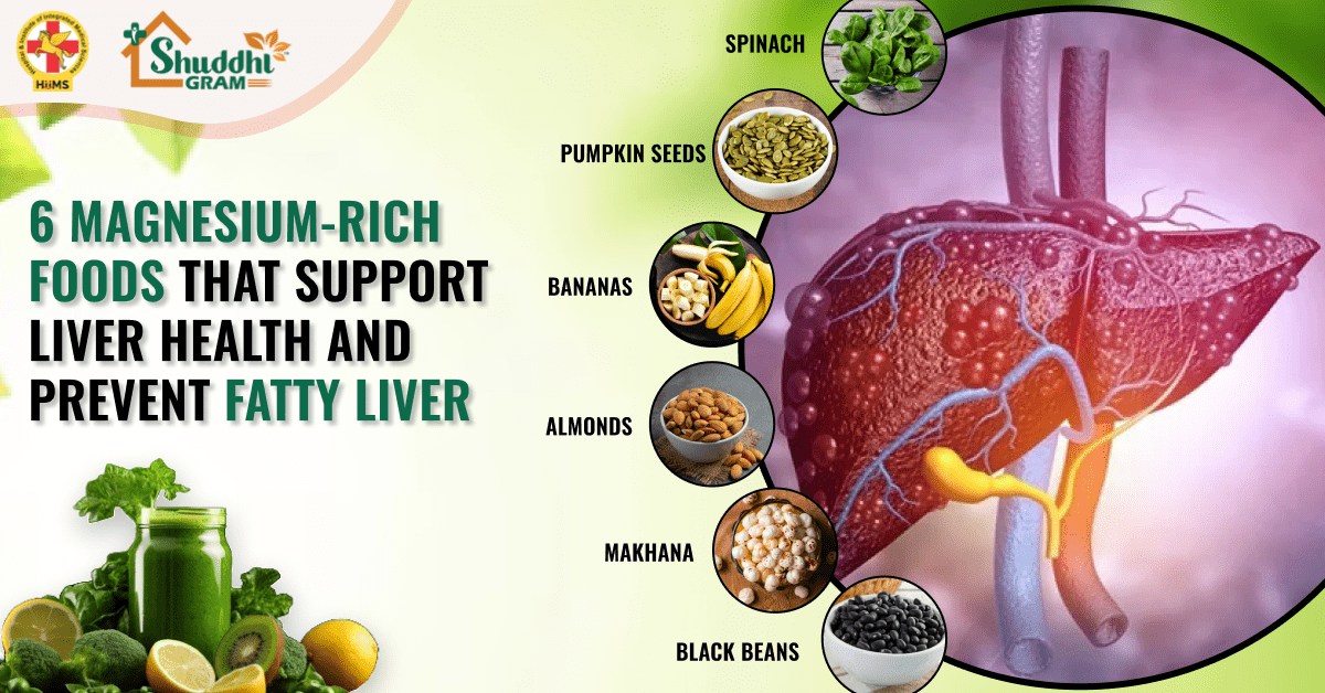 Magnesium-Rich Foods