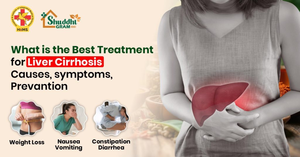 What Is the Best Treatment for Liver Cirrhosis – Causes, Symptoms, Prevention