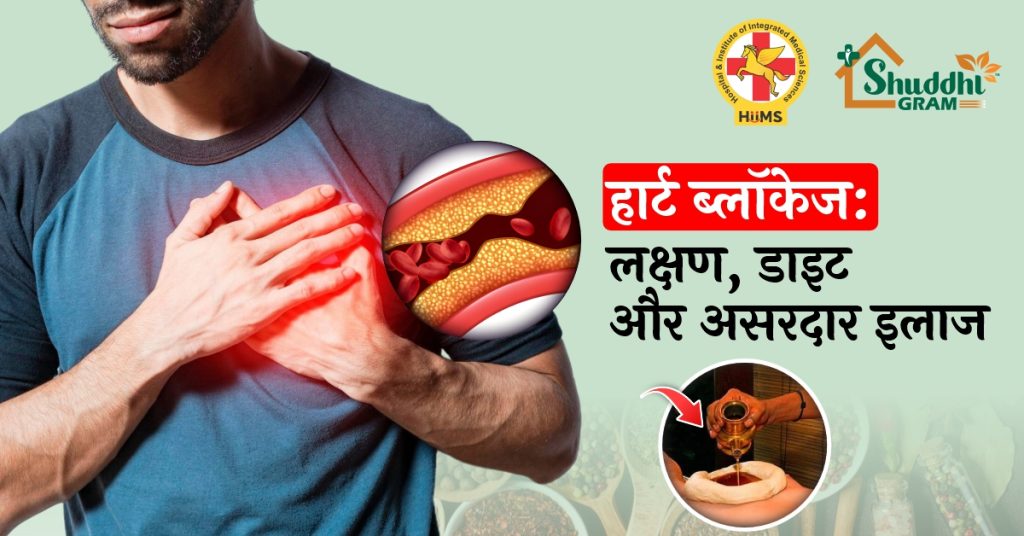हार्ट ब्लॉकेज: लक्षण, डाइट और असरदार इलाज