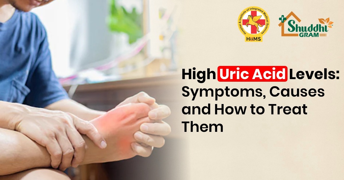 uric acid natural treatment