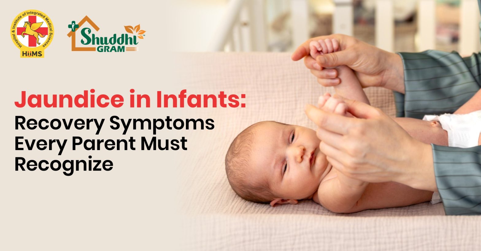 Jaundice in Infants: Recovery Symptoms Every Parent Must Recognize 
