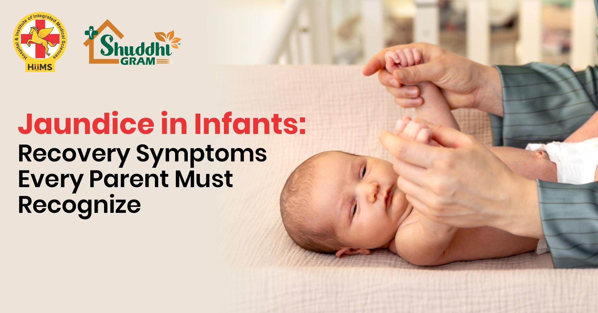 Jaundice in Infants Recovery Symptoms