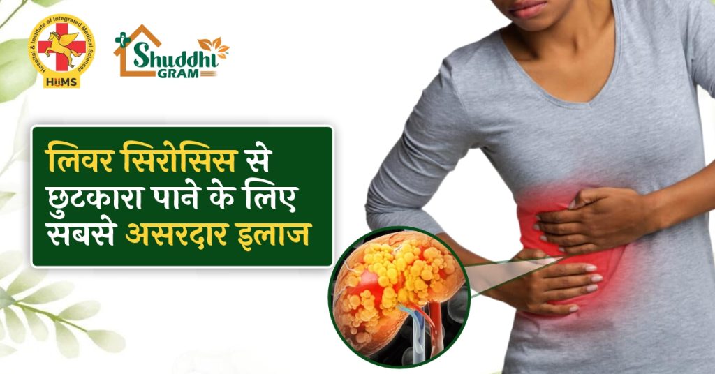 लिवर सिरोसिस का आयुर्वेदिक इलाज